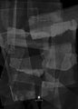 Gepatchtes Schwarz 2 | POSTER